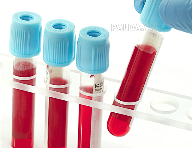 Xét nghiệm máu là cần thiết để thực hiện truyền máu nhanh chóng, kịp thời
